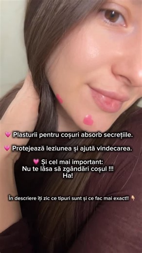 Dr. Teresa Petre | Dermatology | Skincare | on Instagram: "Plasturii pentru coșuri sunt, în majoritatea cazurilor, plasturi hidrocoloidali – un tip de pansament folosit inițial în medicina plăgilor. Mecanismul lor este simplu și bine documentat: absorb secrețiile (sebum, exsudat, puroi) din leziunile acneice superficiale și le transformă într-un gel, creând un mediu protejat care favorizează vindecarea. 🧪 Ce tipuri există: • Plasturi hidrocoloidali simpli – rol principal: absorbție + protecție 