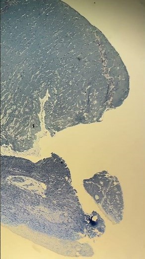 Octopus* under the microscope! 🔬🐙