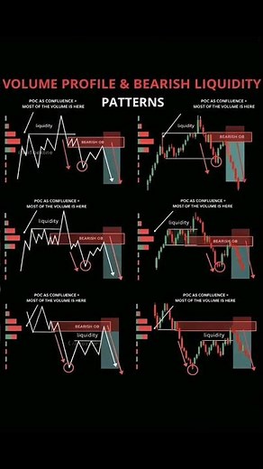 Master Volume Profile & Bearish Liquidity Patterns #trading #tradingstrategy #technicalanalysis