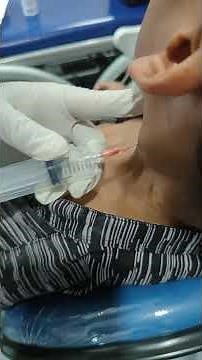 FNAB fine needle aspiration biopsy