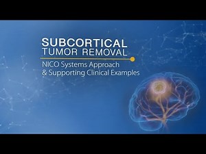 Subcortical Tumor Removal - NICO Systems Approach & Supporting Clinical Examples
