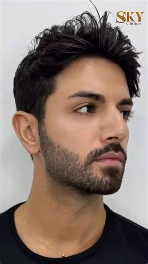 ‎sky beauty clinic-سكاي للتجميل‎ on Instagram‎: "✨ عروض فيلر محدودة… ولمسة تجميل تغيّر ملامحك بشكل طبيعي وأنيق ✨💎 تحبين ملامح مرتّبة بدون مبالغة؟ خدود أرقى، شفايف ممتلئة، بشرة مشدودة… نتائج فورية – بدون جراحة – بخامات عالمية معتمدة 😍🔥 إطلالة ناعمة تدوم… وتخلي جمالك واضح بدون ما حد يعرف إنك عاملة حاجة 💋✨ احجزي الآن واستمتعي بإطلالة مختلفة عن الكل 🤍 📞 للحجز والاستفسار تواصل معنا عبر الرسائل #SkyTouch #sky_clinics #فيلر #بوتوكس #fillerresults fillerbeforeandafter تجميل شفايف خدود cairobeauty