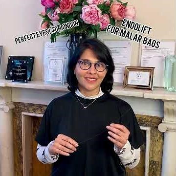 Endolift laser for festoons and malar bags