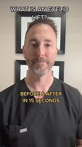 What is a blepharoplasty (eyelid lift)? | Dr. Algie LaBrasca Plastic Surgery