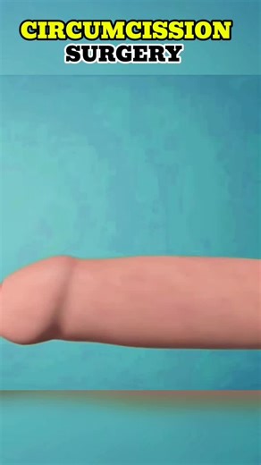 Part 2 |✨CIRCUMCISSON SURGERY🩺🥼 Medical 3D animation and education for public or young trainees #circumcissionsurgery #surgicalcare #viralhealthinfo #surgerystepbystep #Educationalsurgery #foryou #100kviews #medicalprocedure #menhealthmatters