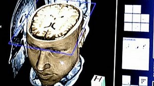 Quick scan could diagnose autism