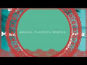 After delivery Manual Removal of Placenta