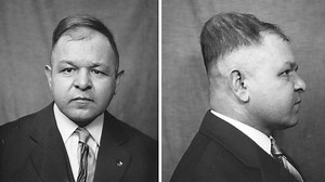 Parasagittal Meningioma | Cohen Collection | Volumes | The Neurosurgical Atlas