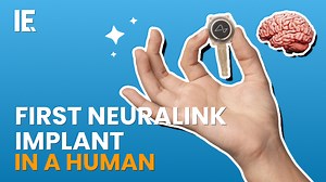 Neuralink plant the first implant in a human brain