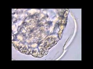 The vitrification process