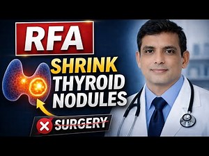 RFA (Radiofrequency Ablation) for Thyroid Nodule: What to Expect During the Procedure