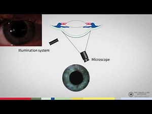 Slit Lamp Techniques Conical Beam