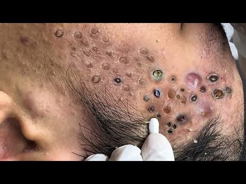 𝑺𝒐𝒐𝒕𝒉𝒊𝒏𝒈 𝑭𝒂𝒄𝒊𝒂𝒍 𝑻𝒓𝒆𝒂𝒕𝒎𝒆𝒏𝒕 𝒇𝒐𝒓 𝑺𝒕𝒓𝒆𝒔𝒔 𝑹𝒆𝒍𝒊𝒆𝒇 | 𝑫𝒆𝒆𝒑 𝑪𝒍𝒆𝒂𝒏𝒊𝒏𝒈 & 𝑪𝒂𝒍𝒎𝒊𝒏𝒈 𝑴𝒂𝒔𝒔𝒂𝒈𝒆 𝒂𝒕 𝑳𝒖𝒙𝒖𝒓𝒚 𝑺𝒑𝒂 #𝟓𝟕𝟗𝟑