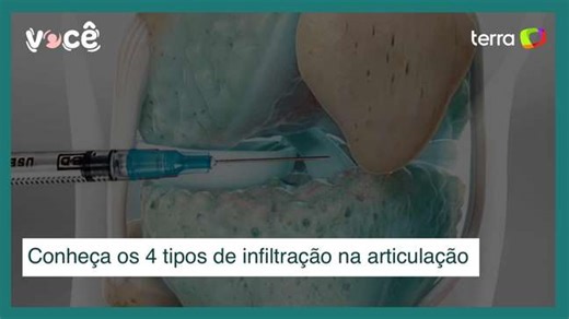 Lua cheia interfere no sono e humor? Neurologista explica a ciência por trás dos mitos lunares