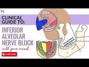 Inferior Alveolar Nerve Block Explained | Anatomy, Halstead Technique & Complications