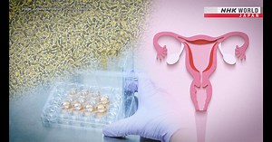 Immunotherapy: New Hope for Uterine Cancer - Medical Frontiers