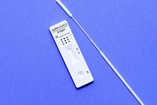 Wie viel kostet ein PCR-Test?