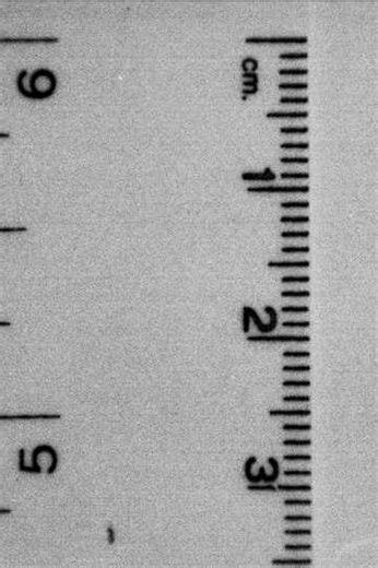 Under observation - Movie