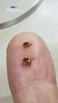 How to protect yourself from ticks
