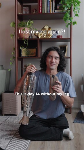 I lost my leg AGAIN Sockets are probably the most annoying thing to deal with especially with weight fluctuations all the time! I keep a lot of my old sizes for when this happens just to have a spare. Sockets will take months at a time to remake and get refitted all while you have to maintain the weight that you are at. The past couple of months my weight gain / loss has been all over the place I ended up gaining too much which meant not reaching the bottom of my socket causing a gap which then 