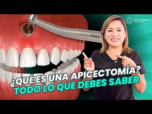 Apicoectomy: What is it and when do you need treatment?