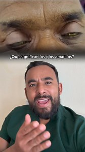¿Qué significa tener los ojos amarillos ? #viralreelsシ | Dr. Esteban Contreras