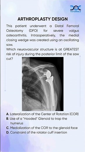 Mastering Arthroplasty | DFO & Neurovascular Safety Explained | DocTutorials