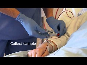 Collecting an arterial line sample