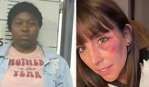 Softball Umpire Says She Was Punched In The Face By 'Mother Of The Year'