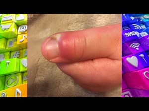 How to Spot an Infection around the Nail