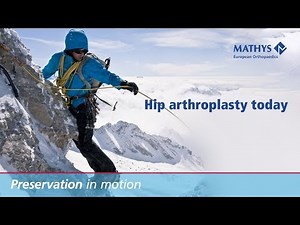 Mathys: Addressing the challenges of the surgeon with a bonepreservation system