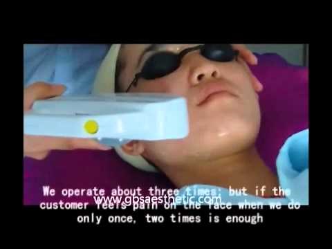 IPL E-light RF and Nd yag laser hair removal and tattoo removal beauty machine