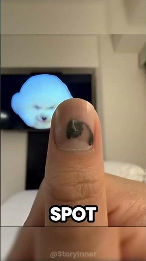 Satisfying Nail Regrowth Time-lapse