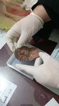 Preserve Kidney Tissue Forever! Epoxy Resin Embedding Tutorial