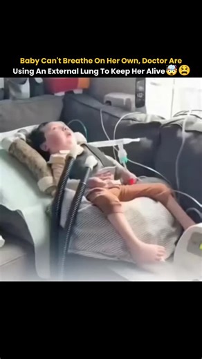 INDIA on Instagram: "This newborn's lungs were too weak to work on their own, so doctors placed her on ECMO, a machine that acts as an external na lung. It oxygenates her blood, removes carbon dioxide, and keeps her alive while her tiny body fights to get stronger. Every second on ECMO is delicate, but she's slowly showing signs improvement thanks to incredible medical care. viewers Are Reacting with Deep Empathyr 640 comments, With many People will feel of ernal sadness for the child's struggle