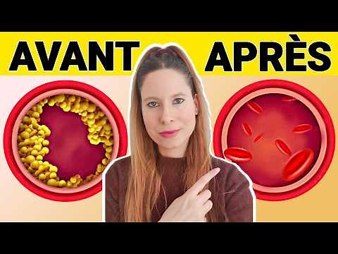 L'aliment n°1 pour DÉBOUCHER vos Artères et Prévenir les AVC