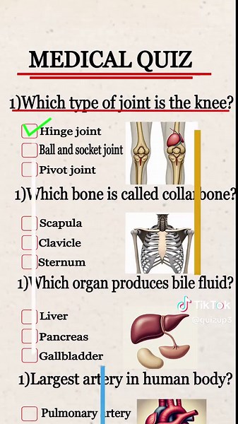 Medical Quiz on Joints and Bones