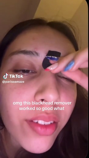 Effective Blackhead Remover Review and Results