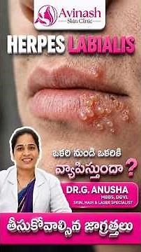 How Herpes Labialis Spreads & Ways to Prevent It | Avinash skim, hair & Laser Specialist