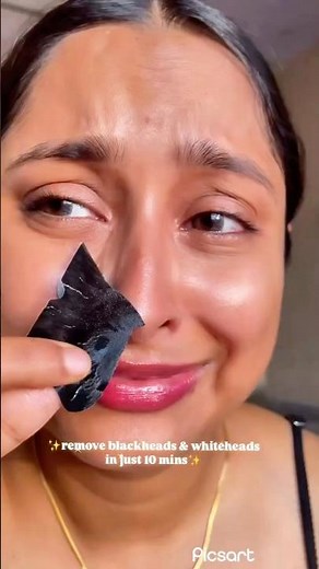 How to Remove Nose Blackheads Fast (Gentle & Effective)