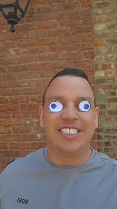 468K views · 4.3K reactions | So happy with the eye surgery. I just want to thank all the team at the clinic who helped. #wrongguysreviews #rightguysreview #funnyvideos #fyp #dailylife | Wrong Guys Reviews | Facebook