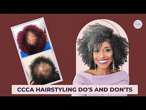 CCCA ALOPECIA HAIRSTYLES DO'S AND DON'TS (PART 1)