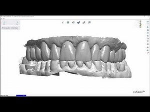Designing digital models in 3Shape to Kois specs
