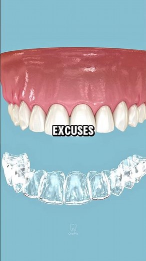 What Happens When You Stop Wearing Your Retainer? 😬🦷 #dentist