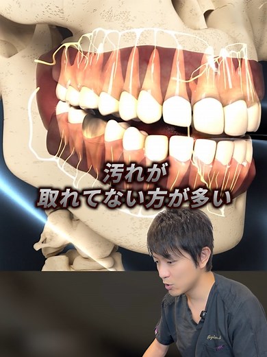 虫歯を放置するリスクと予防法