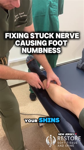 ⚡️What if the numbness in your foot isn’t coming from your back… but from a nerve getting stuck near your knee? 👀👣 In this case, the common peroneal nerve was trapped by adhesion, irritating the nerve and sending numbness and tingling down into the foot. When nerves can’t glide freely through the soft tissue, they become irritated and can create strange symptoms like numbness, tingling, burning, or weakness. By removing the adhesion trapping the common peroneal nerve, we restore the nerve’s ab