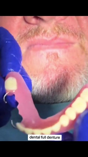 #dental #full #denture #foryoupage❤️❤️ #foryou #partial #teeths #foryou #foryoupage❤️❤️