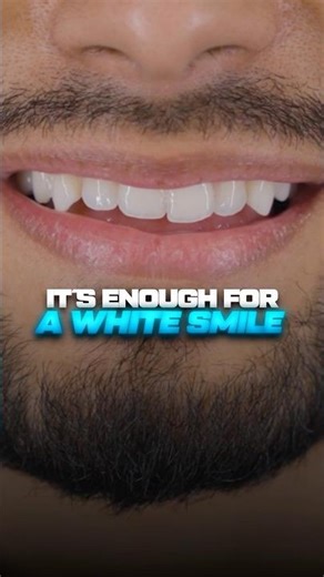 How to get a white smile in 7 days