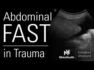 The Abdominal FAST