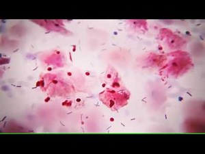 Bacterial Vaginosis, LM .